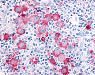 IHC - SEH / EPHX2 Antibody (Internal) ALS11045